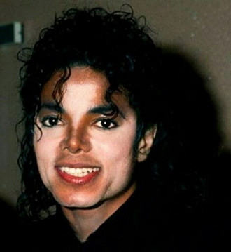 Michael Jackson sofria de Vitiligo