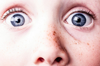 Pessoas de olhos azuis são mais sensíveis à luz