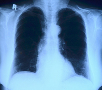 25 fatos surpreendentes sobre seus pulmões